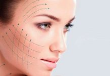 Rejuvenecimiento e Hilos Tensores: me sirven? Hilos Tensores en Soloestetica