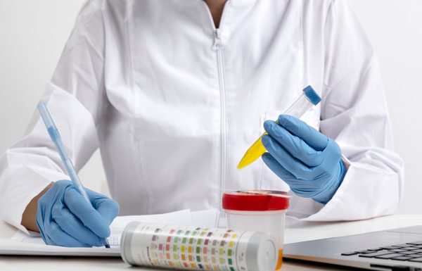 Perfil Lipídico: Cómo Evaluar tu Colesterol y Proteger tu Corazón Perfil Lipídico: Cómo Evaluar tu Colesterol y Proteger tu Corazón