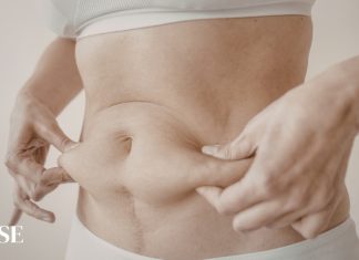 Lipoescultura: cuando la Grasa deja de ser Enemiga Lipoescultura: cuando la Grasa deja de ser Enemiga