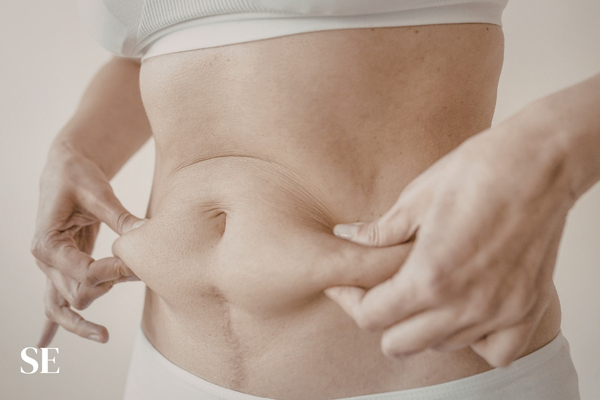 Lipoescultura: cuando la Grasa deja de ser Enemiga